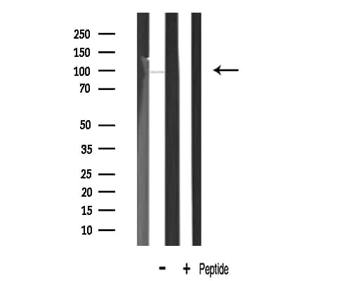 Polyclonal Rabbit anti-Human LTK Antibody (IF, WB)