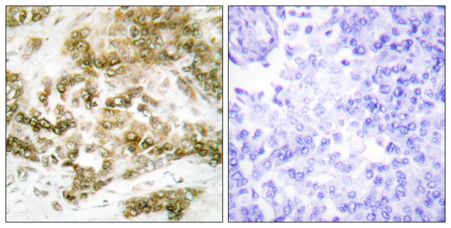 TBX15+18 Antibody (Internal)