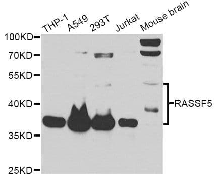 Polyclonal Rabbit anti-Human RASSF5 / RAPL Antibody (WB)