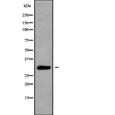 Polyclonal Rabbit anti-Human HOXC12 Antibody (WB)