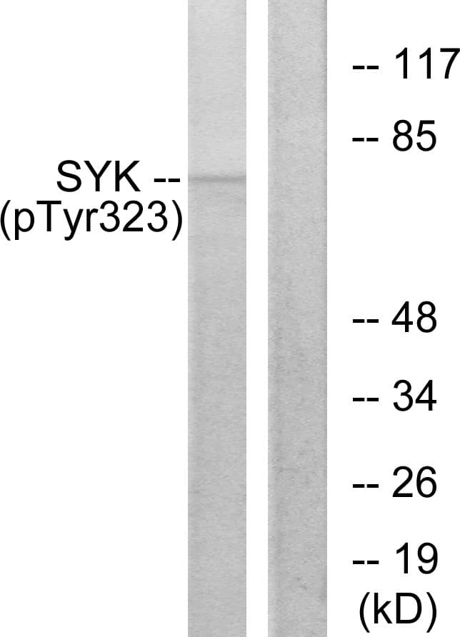 Polyclonal Rabbit anti-Human SYK Antibody (phospho-Tyr323, IHC, IF, WB)