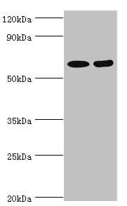 Polyclonal Rabbit anti-Human ASMTL Antibody (aa1-290, IHC, WB)