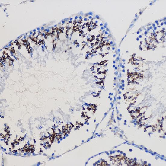 NOTCH1 Antibody