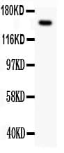 c-Met Antibody (aa208-407)
