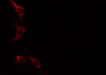 LIPE / HSL Antibody (phospho-Ser552)