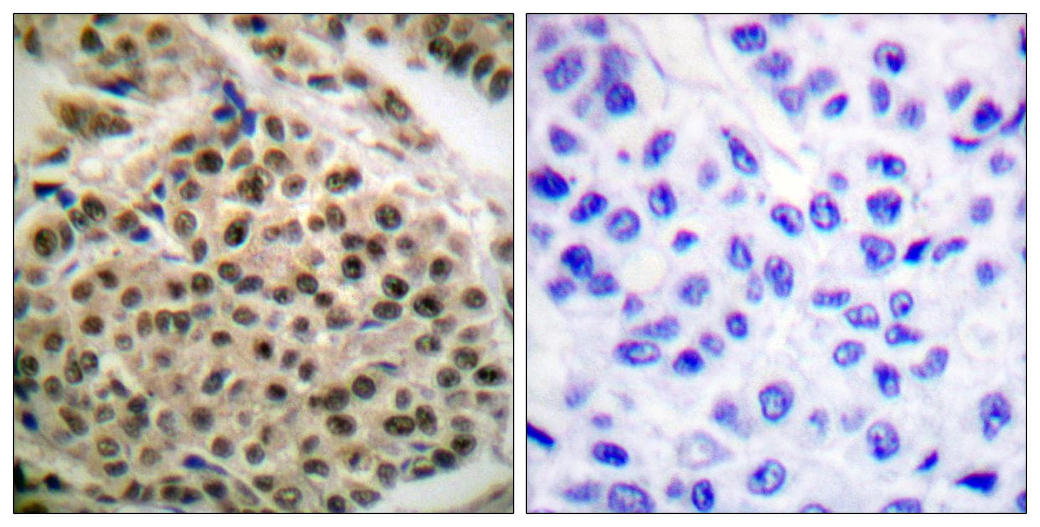 NFKB1 / NF-Kappa-B Antibody (phospho-Ser927)