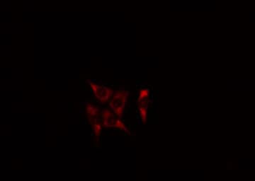 Polyclonal Rabbit anti-Human JTB / PAR Antibody (IF, WB)
