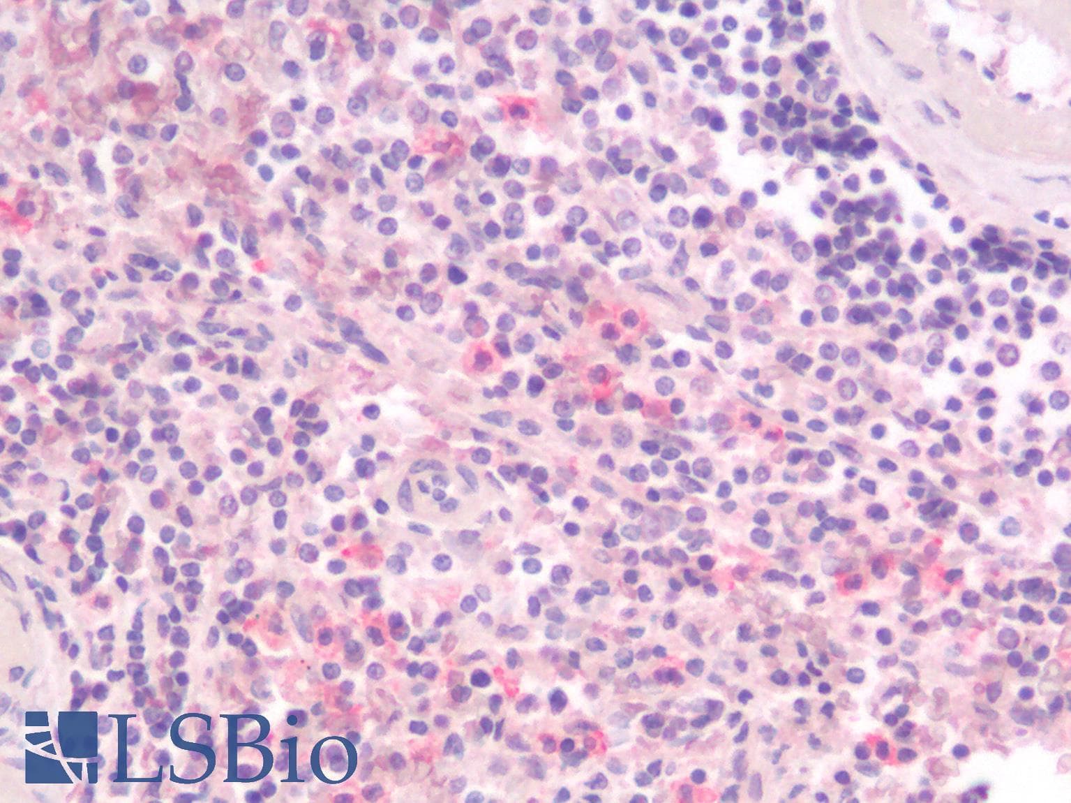 IHC-plus™ LAG3 Antibody