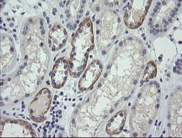 CTAG1B / NY-ESO-1 Antibody (clone OTI9H6, Carrier-free)