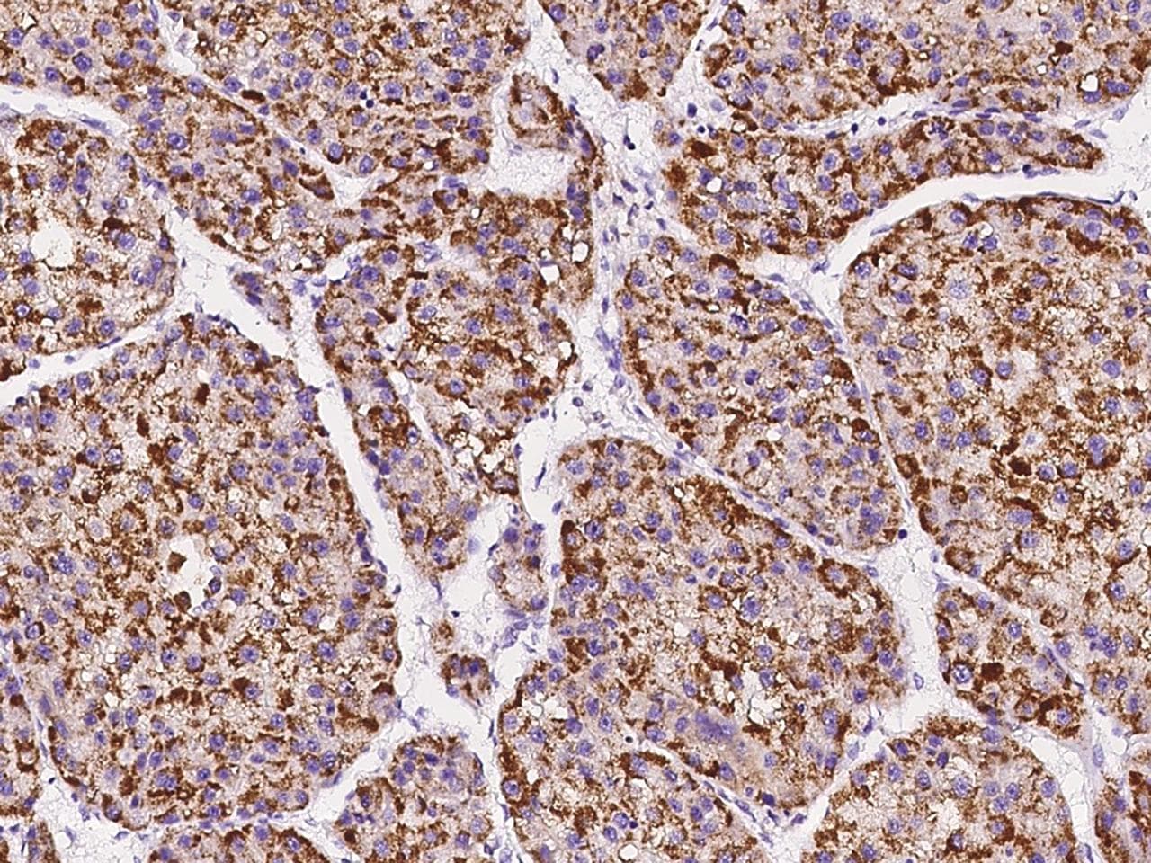 Polyclonal Rabbit anti-Human PIPOX / Sarcosine Oxidase Antibody (IHC)