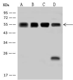 PHGDH Antibody