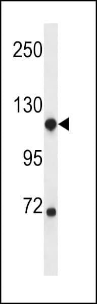 NDST1 Antibody (aa820-849)