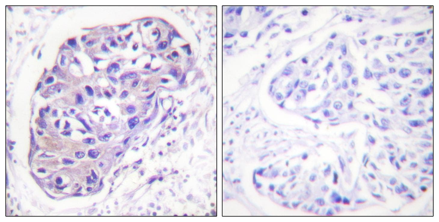 ADRBK1 / GRK2 Antibody
