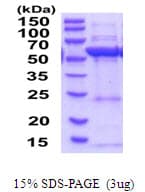 Human HMGCS1 / HMG-CoA Synthase 1 Protein (Recombinant His)