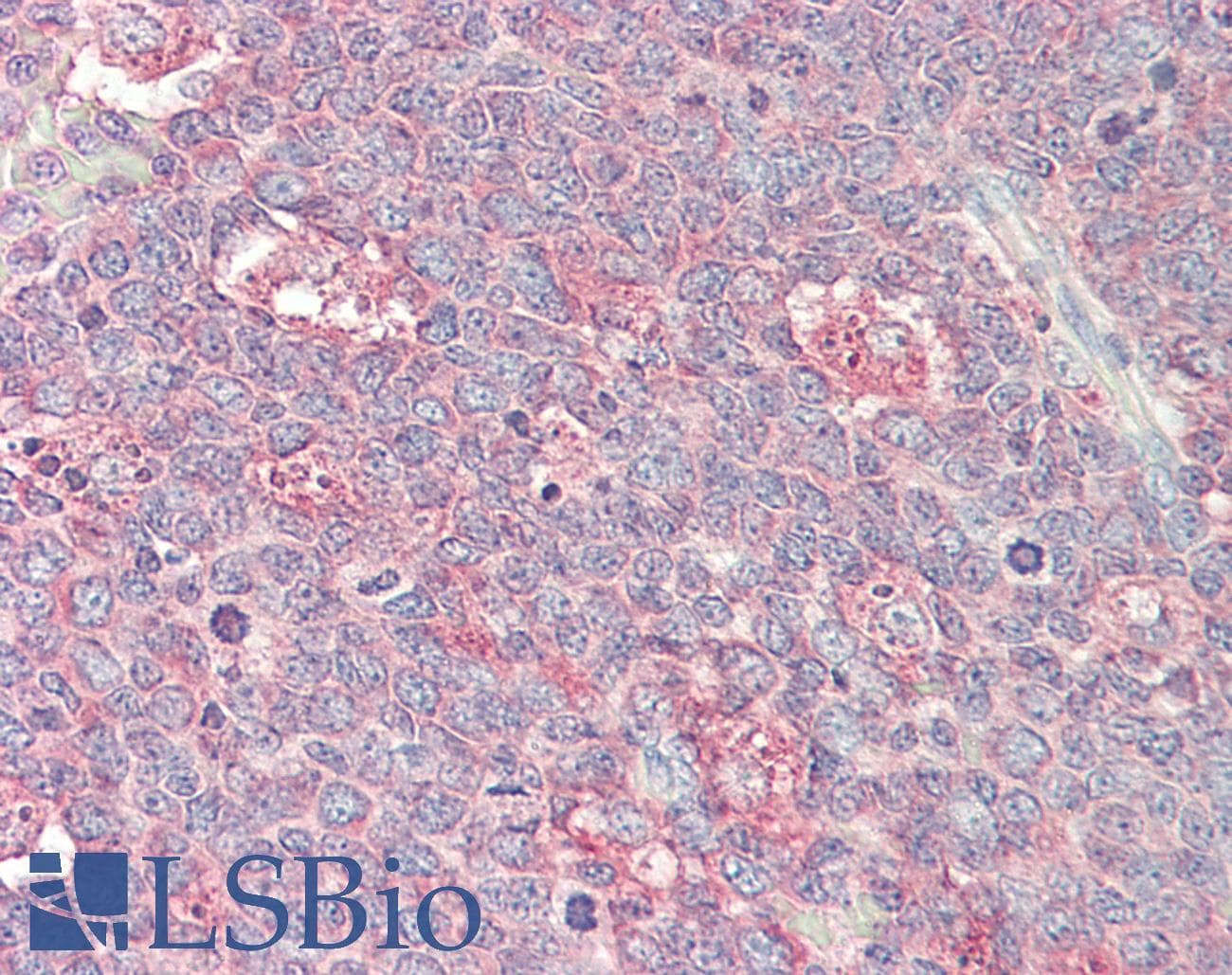 IHC-plus™ p21-ARC / ARPC3 Antibody