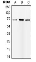 Polyclonal Rabbit anti-Human IGFALS / ALS Antibody (Internal, WB)