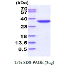Human NQO1 Protein (Recombinant His)