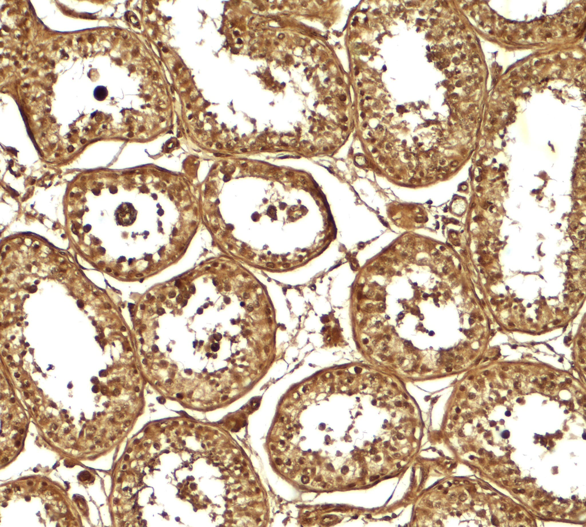 AKAP82 / AKAP4 Antibody