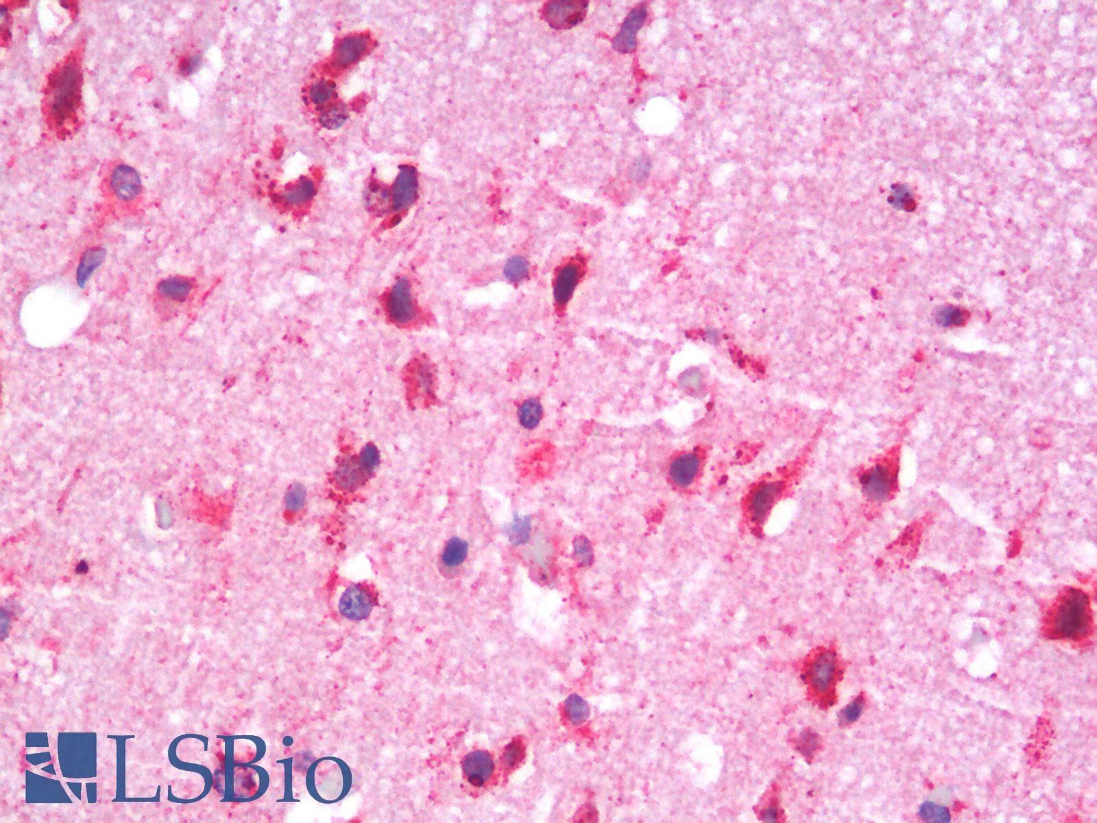IHC-plus™ HSPA5 / GRP78 / BiP Antibody