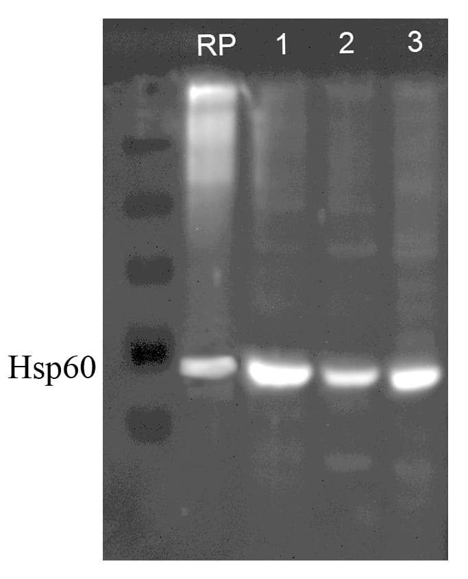 PathPlus™ Polyclonal Rabbit anti-Human HSPD1 / HSP60 Antibody (IHC, WB)