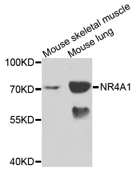 IHC-plus™ NR4A1 / NUR77 Antibody