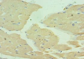 Polyclonal Rabbit anti-Human MYH1 Antibody (aa1-100, IHC)