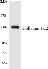 IHC-plus™ COL1A2 / Collagen I Alpha 2 Antibody (aa452-501)