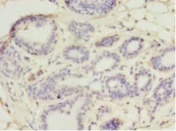 UBE2D1 / UBCH5 Antibody