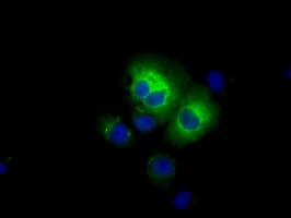 IHC-plus™ ALDH3A1 Antibody (clone 1B6)