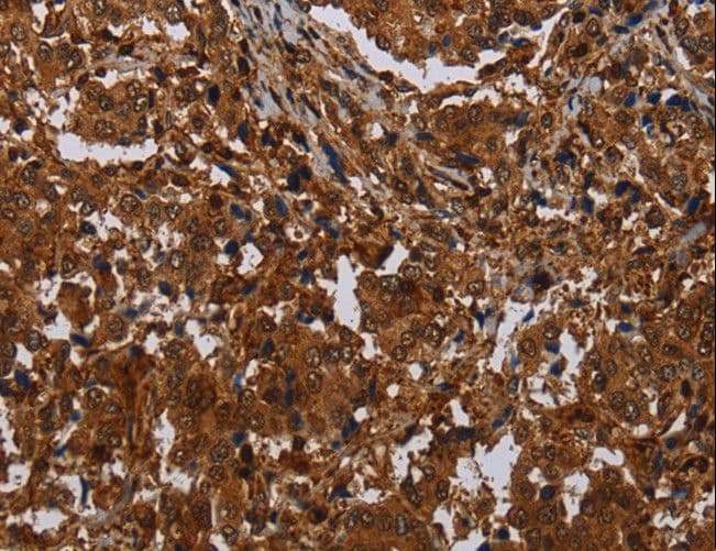 MAGEB18 Antibody