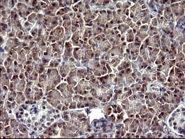 SERPINB3 Antibody (clone OTI1G1)