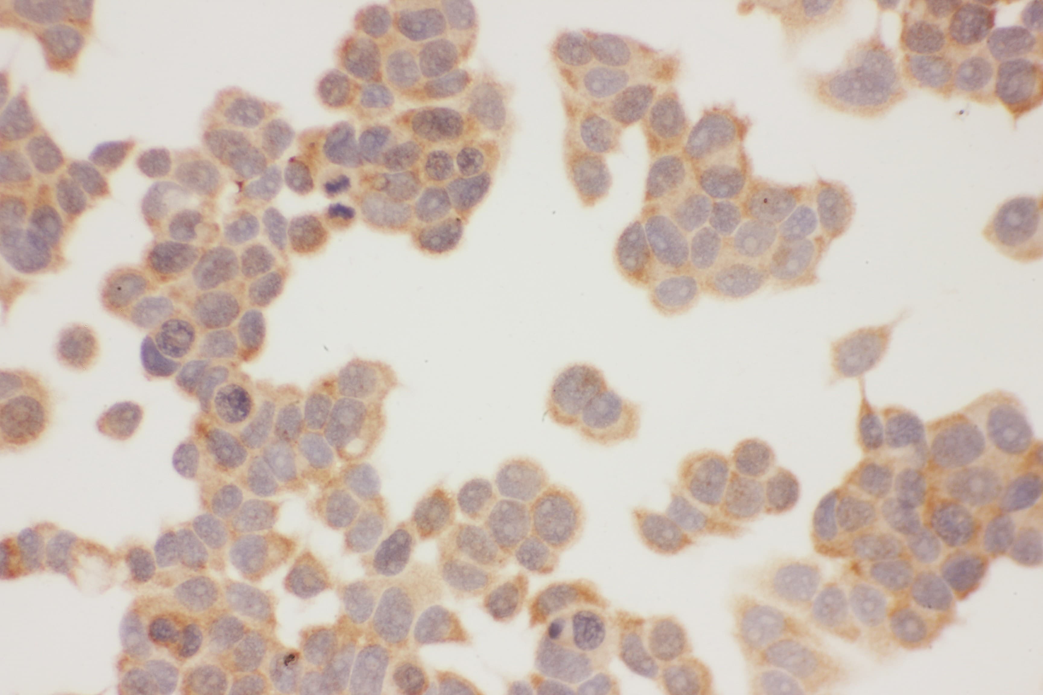 HSP90AA1 / Hsp90 Alpha A1 Antibody (aa2-365)