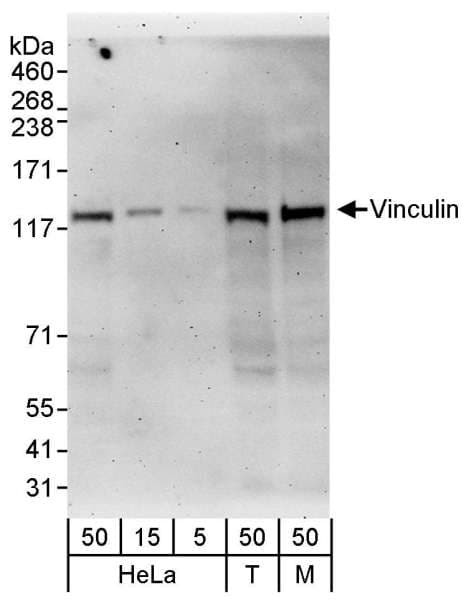 Polyclonal Rabbit anti-Human VCL / Vinculin Antibody (aa750-800, WB)