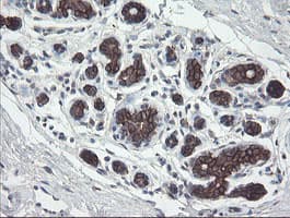 DPH2 Antibody (clone OTI2B12)