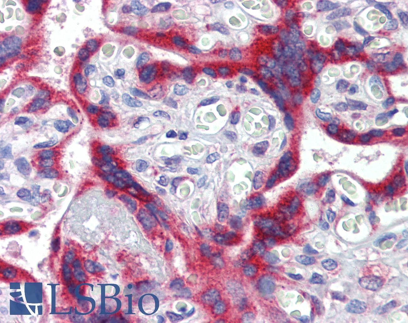 IHC-plus™ Monoclonal Mouse anti-Human ERBB3 / HER3 Antibody (clone 3F10F6, IHC, WB)