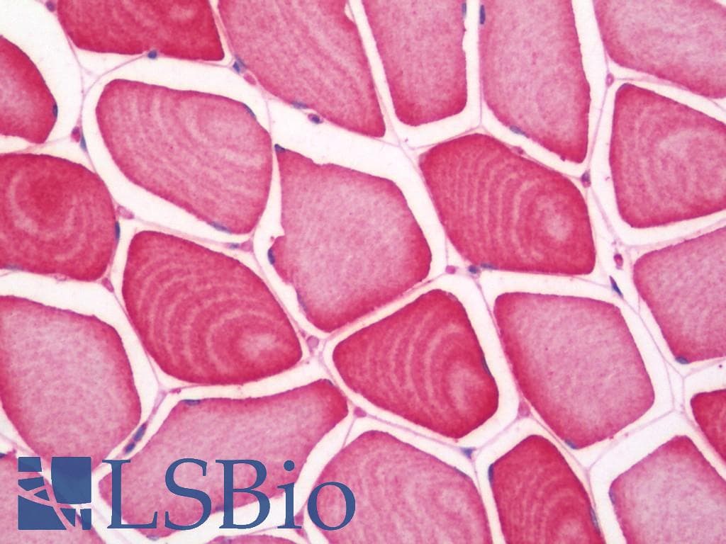 IHC-plus™ SLC29A2 / ENT2 Antibody