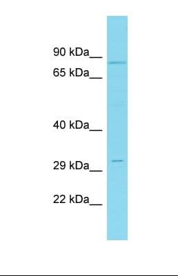 Polyclonal Rabbit anti-Human CNOT10 Antibody (aa571-620, WB)