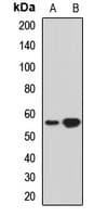 Polyclonal Rabbit anti-Human THUMPD3 Antibody (WB)
