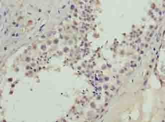 Polyclonal Rabbit anti-Human BATF2 / SARI Antibody (IHC)