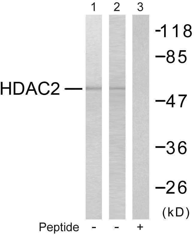 HDAC2 Antibody (p394)