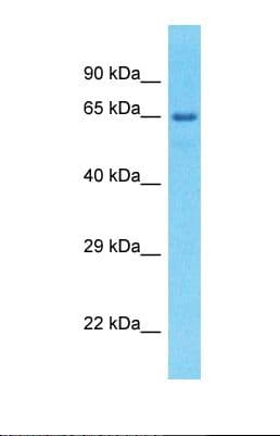 Polyclonal Rabbit anti-Human EFHC1 Antibody (aa180-229, WB)