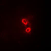 Polyclonal Rabbit anti-Human SYK Antibody (IHC, IF, WB)