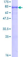 Human HNRNPK / hnRNP K Protein (Recombinant GST)