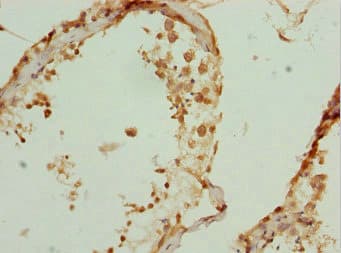 ZBTB25 Antibody