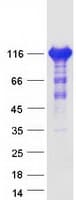 Human AFAP1L2 / XB130 Protein (Recombinant Myc-DDK (Flag))