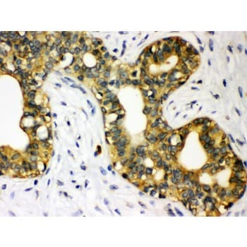 Polyclonal Rabbit anti-Human STAT1 Antibody (aa114-143, IHC, WB)
