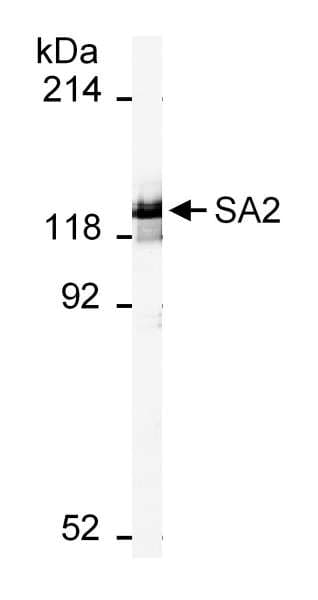 IHC-plus™ Polyclonal Goat anti-Human STAG2 Antibody (aa1100-1150, IHC, WB)
