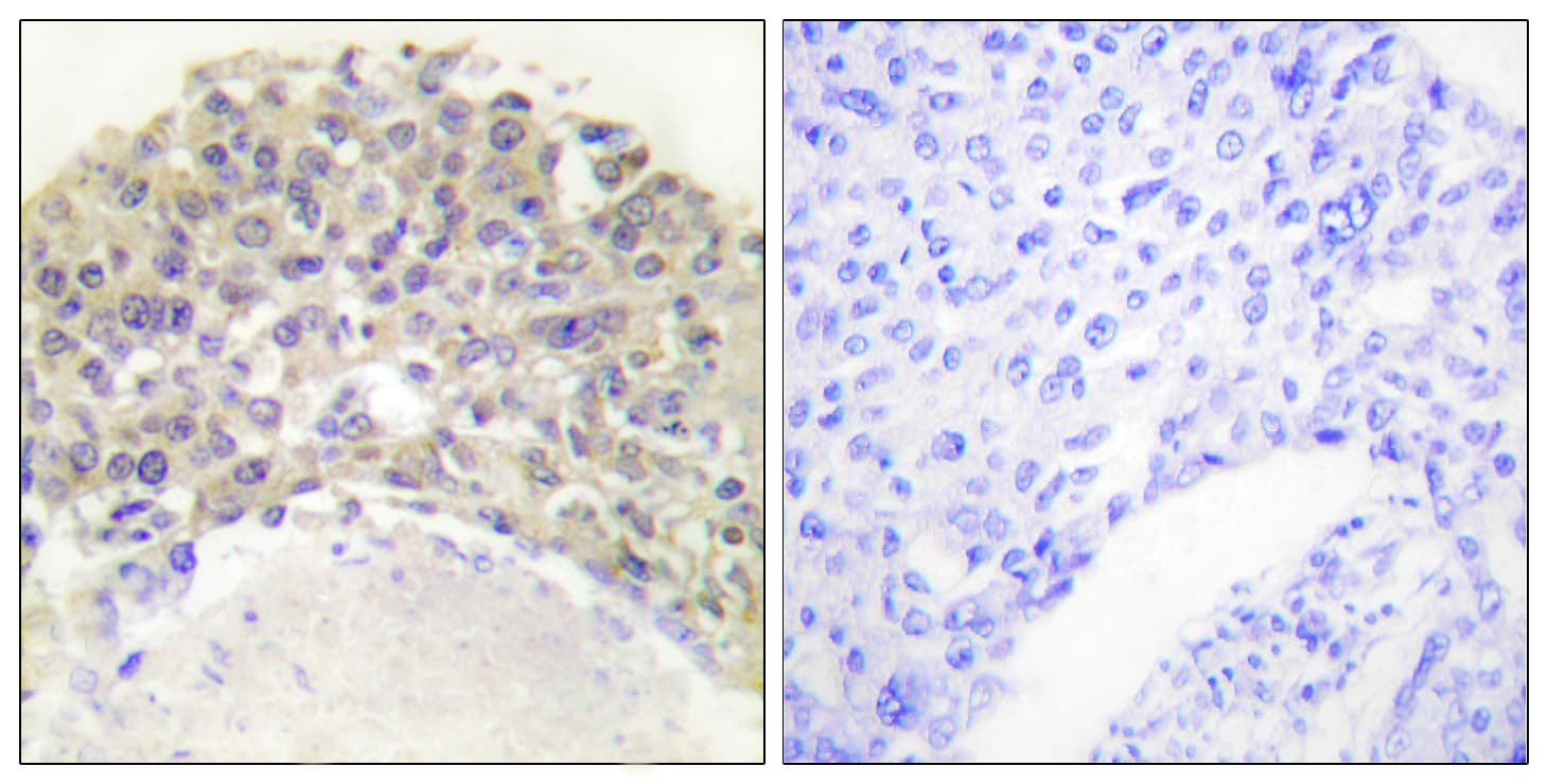 p66 / SHC Antibody (phospho-Tyr349)