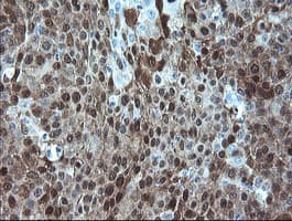ADH7 Antibody (clone OTI2H10)