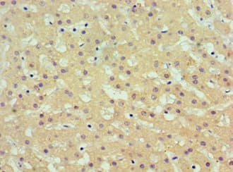 AKR1C4 / Chlordecone Reductase Antibody (aa1-323)